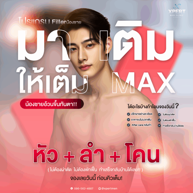 ฟิลเลอร์-01